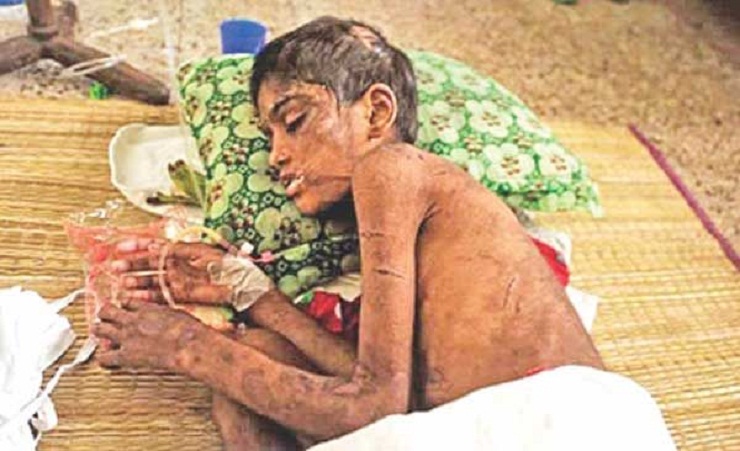 Child Domestic Worker Abandoned, Brutally Tortured in Dhaka | OngoingNow24